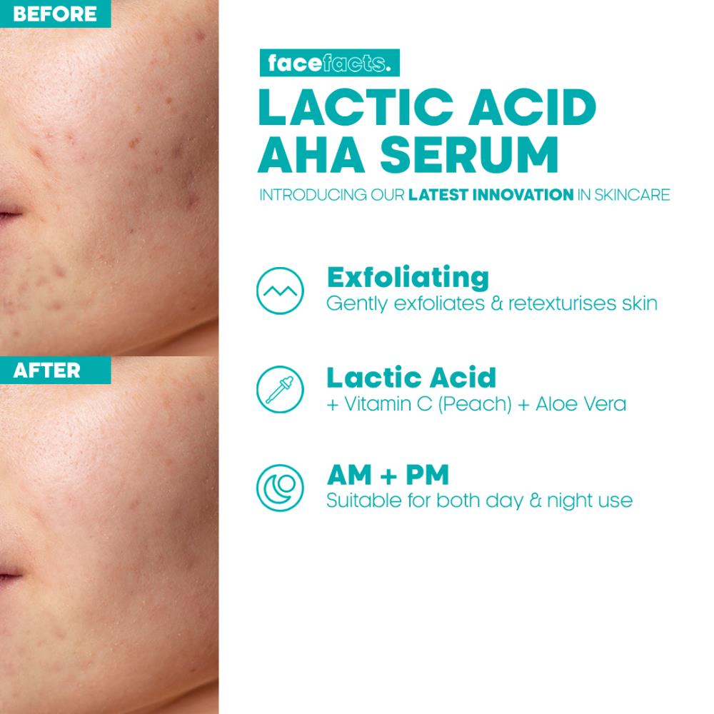 Lactic Acid Facial Serum