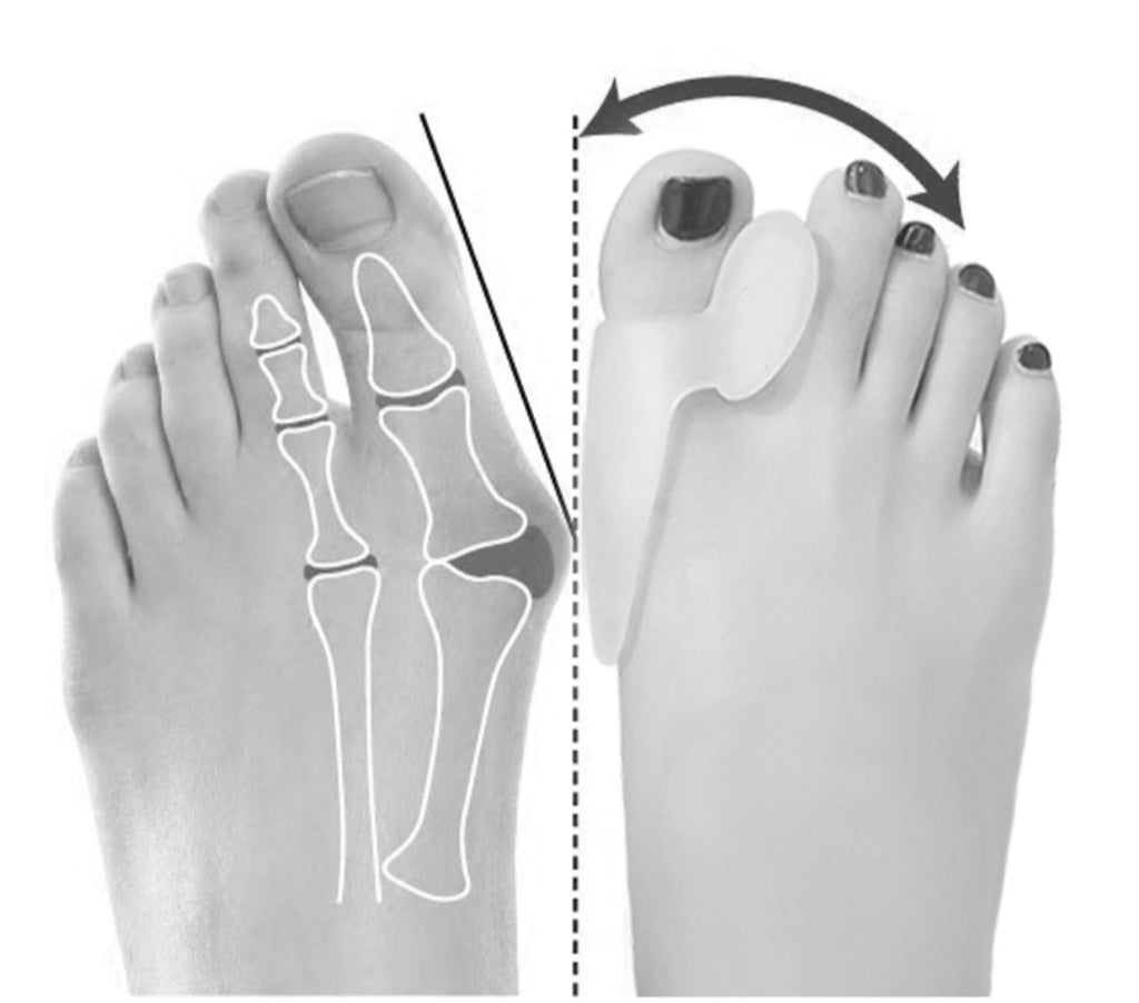 Silicone Toe separator